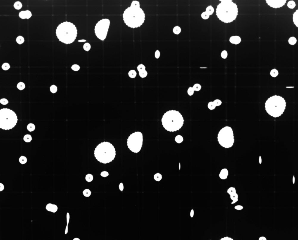 Radius